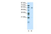 Antibody used in WB on Human HepG2 at 5.0 ug/ml.