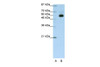 Antibody used in WB on Transfected 293T at 1.25 ug/ml.