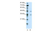 Antibody used in WB on Human Jurkat 2.5 ug/ml.