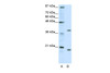 Antibody used in WB on Human HepG2 at 0.2-1 ug/ml.