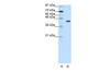 Antibody used in WB on Human HepG2 at 1.25 ug/ml.