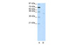 Antibody used in WB on Human HepG2 at 2.5 ug/ml.