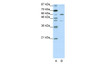 Antibody used in WB on Human HepG2 at 1.25 ug/ml.