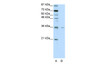 Antibody used in WB on Human HepG2 at 2.5 ug/ml.