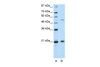 Antibody used in WB on Human HepG2 at 2.5 ug/ml.