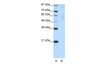 Antibody used in WB on Human HepG2 at 2.5 ug/ml.