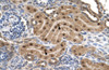 Antibody used in IHC on Human kidney.