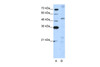 Antibody used in WB on Human Jurkat 5.0 ug/ml.