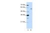 Antibody used in WB on Human HepG2 at 1.25 ug/ml.