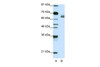 Antibody used in WB on Human Jurkat 1.25 ug/ml.