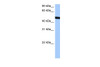 Antibody used in WB on Human HepG2 at 0.2-1 ug/ml.
