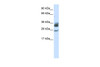 Antibody used in WB on Human Heart at 5.0 ug/ml.