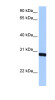 Antibody used in WB on Human HepG2 at 0.2-1 ug/ml.