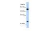 Antibody used in WB on Human HepG2 at 2.5 ug/ml.