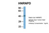 Antibody used in WB on Hum. Adult Placenta at 1 ug/ml.