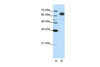 Antibody used in WB on Human HepG2 at 0.2-1 ug/ml.