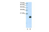 Antibody used in WB on Human Jurkat 1.25 ug/ml.