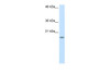 Antibody used in WB on Human HepG2 at 2.5 ug/ml.