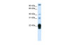 Antibody used in WB on Human Placenta at 1.25 ug/ml.