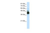 Antibody used in WB on Human Jurkat 0.2-1 ug/ml.