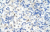 Antibody used in IHC on Human Liver at 4.0-8.0 ug/ml.