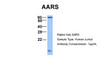 Antibody used in WB on Human Jurkat 1 ug/ml.