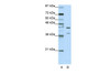 Antibody used in WB on Human HepG2 at 1.25 ug/ml.