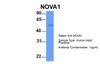 Antibody used in WB on Hum. Adult Placenta at 1 ug/ml.