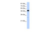 Antibody used in WB on Human HepG2 at 1.25 ug/ml.