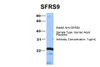 Antibody used in WB on Hum. Adult Placenta at 1 ug/ml.