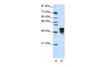 Antibody used in WB on Human Jurkat cells at 1.25 ug/ml.