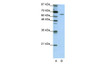 Antibody used in WB on Human HepG2 at 1.25 ug/ml.