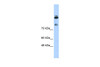 Antibody used in WB on Human Jurkat 0.2-1 ug/ml.