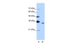 Antibody used in WB on Human K562 cells at 1.25 ug/ml.