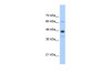 Antibody used in WB on Human HepG2 at 0.2-1 ug/ml.