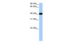 Antibody used in WB on Human Lung at 0.2-1 ug/ml.