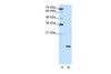 Antibody used in WB on Human Jurkat cells at 0.2-1 ug/ml.