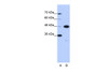 Antibody used in WB on Human Jurkat 0.2-1 ug/ml.