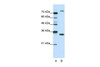 Antibody used in WB on Human Jurkat cells at 1.25 ug/ml.