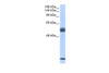 Antibody used in WB on Human Placenta at 0.2-1 ug/ml.