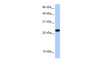 Antibody used in WB on Human Placenta at 0.2-1 ug/ml.