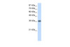 Antibody used in WB on Human Jurkat 1.25 ug/ml.