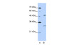 Antibody used in WB on Human Jurkat 2.5 ug/ml.