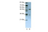 Antibody used in WB on Human Jurkat 1.25 ug/ml.