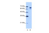 Antibody used in WB on Human Jurkat 1.25 ug/ml.