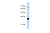 Antibody used in WB on Human HepG2 at 0.25 ug/ml.