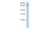 Antibody used in WB on Human HepG2 at 0.2-1 ug/ml.