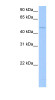 Antibody used in WB on Human Jurkat 0.2-1 ug/ml.