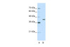 Antibody used in WB on Human HepG2 at 2.5 ug/ml.