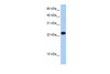 Antibody used in WB on Human Liver at 0.2-1 ug/ml.